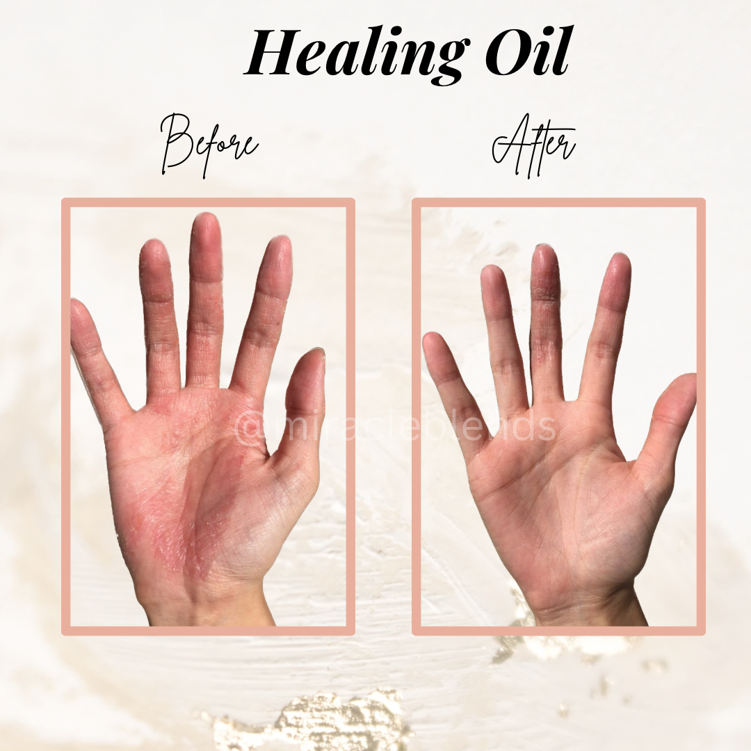 Miracle Healing Oil